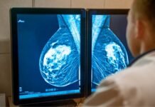Câncer de mama deve atingir mais de 78 mil mulheres no Brasil em 2026